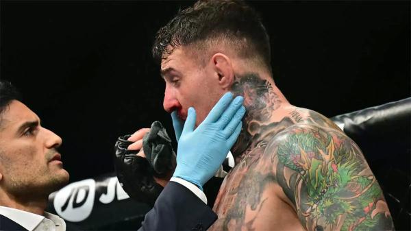 Доктор – о травме Аспиналла: «Мы не нашли ничего опасного»